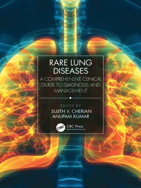 Anupam Kumar, Sujith V. Cherian - Rare Lung Diseases, E-bok