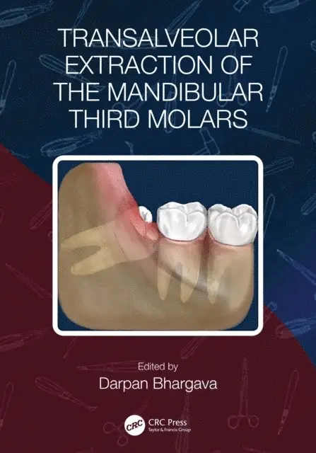 Darpan Bhargava - Transalveolar Extraction of the Mandibular Third Molars, E-bok. Tillgänglighet: Lägg i varukorg