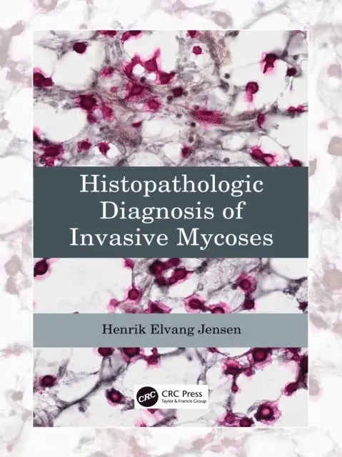 Henrik Elvang Jensen - Histopathologic Diagnosis of Invasive Mycoses, E-bok. Tillgänglighet: Lägg i varukorg