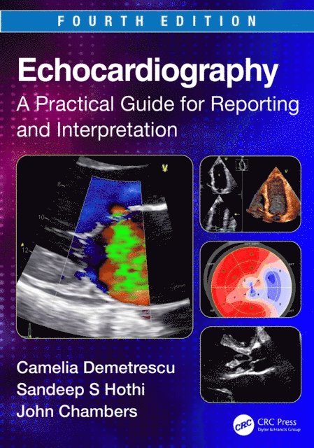 John Chambers, Sandeep S. Hothi, Camelia Demetrescu - Echocardiography, E-bok