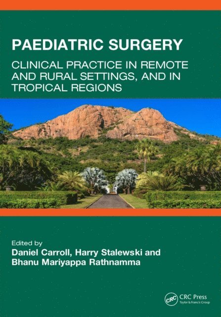 Bhanu Mariyappa Rathnamma, Harry Stalewski, Daniel Carroll - Paediatric Surgery, E-bok. Tillgänglighet: Lägg i varukorg