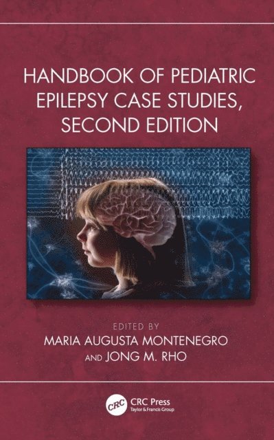 Jong M. Rho, Maria Augusta Montenegro - Handbook of Pediatric Epilepsy Case Studies, Second Edition, E-bok
