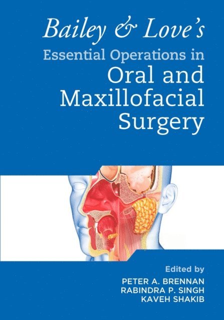 Kaveh Shakib, Rabindra Singh, Peter A. Brennan - Bailey & Love's Essential Operations in Oral & Maxillofacial Surgery, E-bok