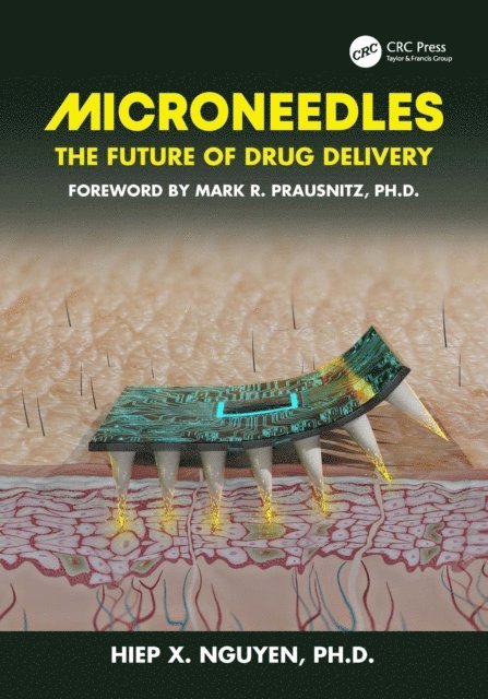 Hiep Xuan Nguyen - Microneedles, E-bok. Tillgänglighet: Lägg i varukorg