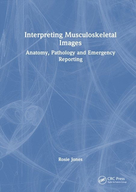 Rosie Jones - Interpreting Musculoskeletal Images, E-bok