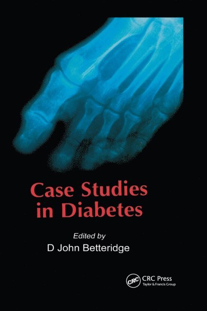 D John Betteridge - Case Studies in Diabetes, E-bok. Tillgänglighet: Lägg i varukorg