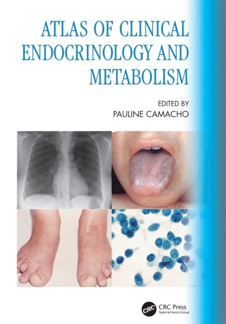 Pauline Camacho - Atlas of Clinical Endocrinology and Metabolism, E-bok