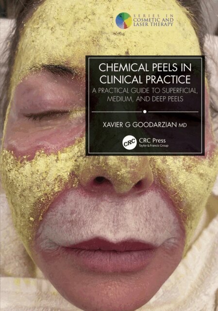 Xavier G Goodarzian - Chemical Peels in Clinical Practice, E-bok