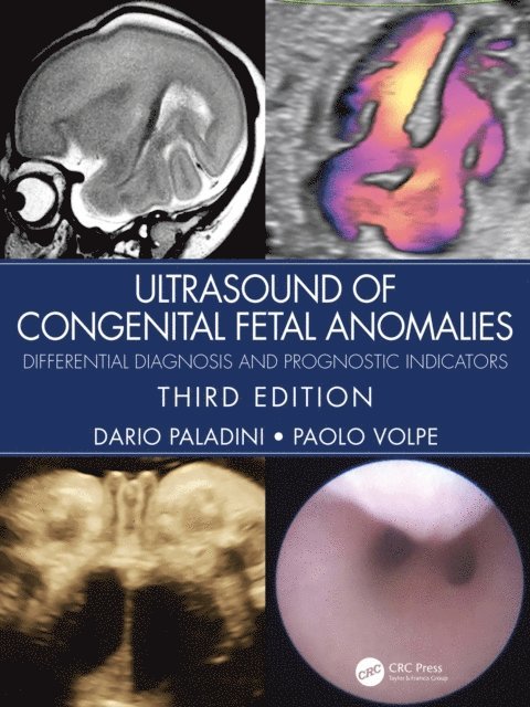 Paolo Volpe, Dario Paladini - Ultrasound of Congenital Fetal Anomalies, E-bok