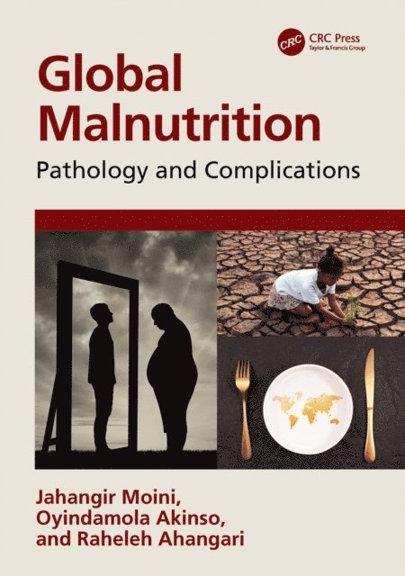 Raheleh Ahangari, Oyindamola Akinso, Jahangir Moini - Global Malnutrition, E-bok