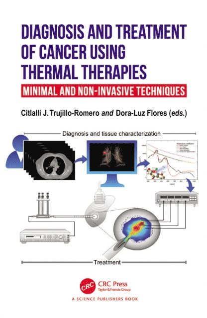 Dora-Luz Flores, Citlalli J. Trujillo Romero - Diagnosis and Treatment of Cancer using Thermal Therapies, E-bok