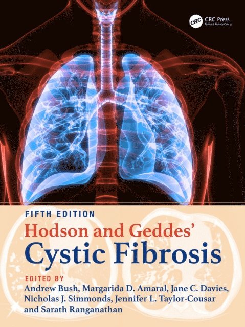 Sarath C. Ranganathan, Jennifer L. Taylor-Cousar, Nicholas J. Simmonds, Jane C. Davies, Margarida D. Amaral, Andrew Bush - Hodson and Geddes' Cystic Fibrosis, E-bok