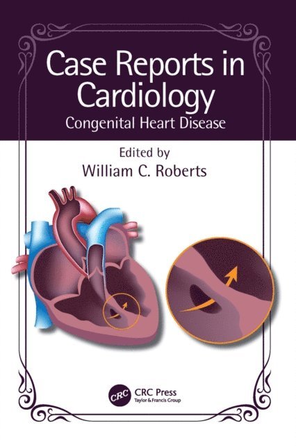 William C. Roberts - Case Reports in Cardiology, E-bok. Tillgänglighet: Lägg i varukorg
