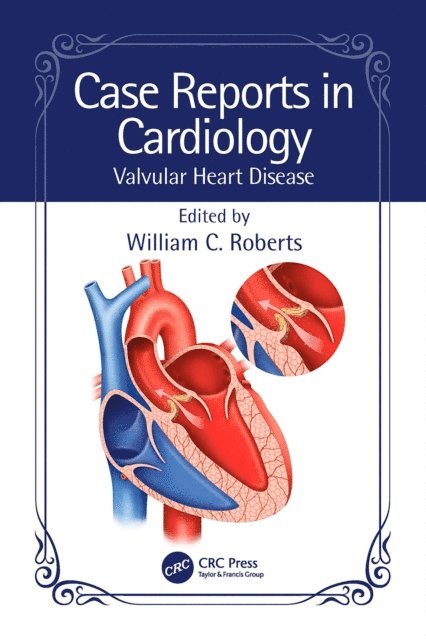 William C. Roberts - Case Reports in Cardiology, E-bok. Tillgänglighet: Lägg i varukorg