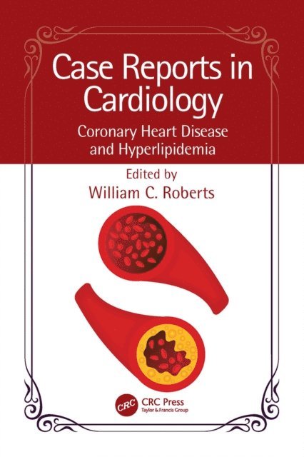 William C. Roberts - Case Reports in Cardiology, E-bok. Tillgänglighet: Lägg i varukorg