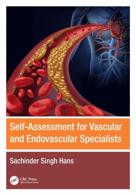 Sachinder Singh Hans - Self-Assessment for Vascular and Endovascular Specialists, E-bok. Tillgänglighet: Lägg i varukorg