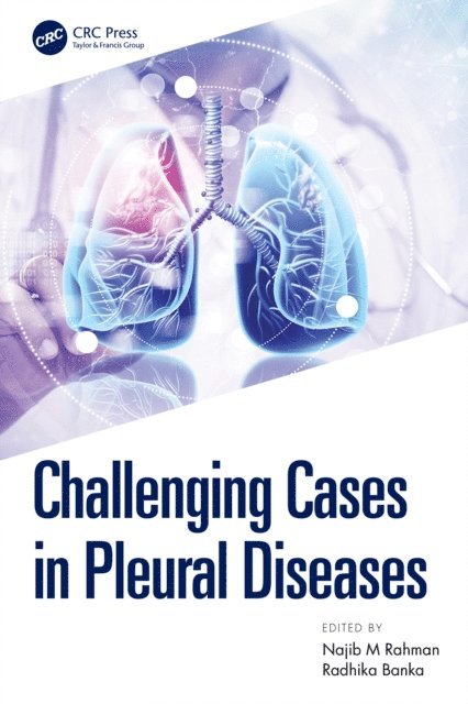 Radhika Banka, Najib Rahman - Challenging Cases in Pleural Diseases, E-bok