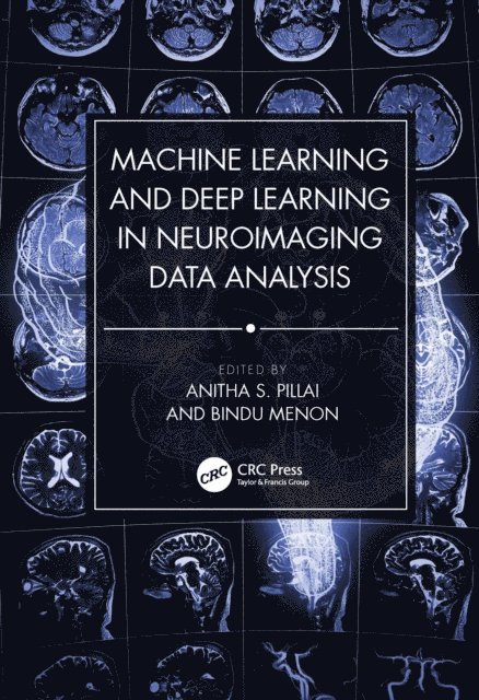 Bindu Menon, Anitha S. Pillai - Machine Learning and Deep Learning in Neuroimaging Data Analysis, E-bok