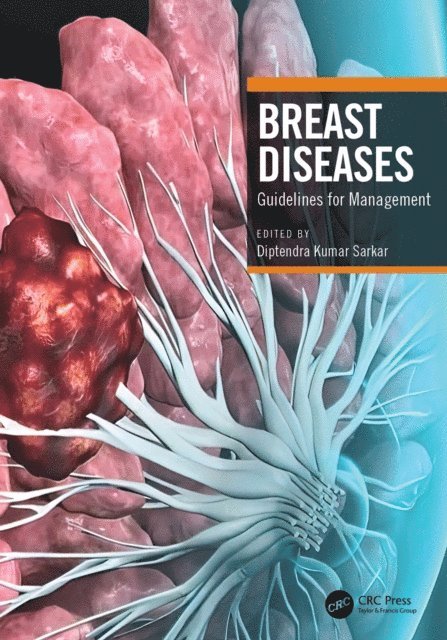 Diptendra Kumar Sarkar - Breast Diseases, E-bok