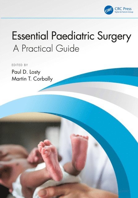 Martin T Corbally, Paul D Losty - Essential Paediatric Surgery, E-bok