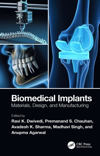Anupma Agarwal, Madhavi Singh, Avadesh K. Sharma, Premanand S. Chauhan, Ravi K. Dwivedi - Biomedical Implants, E-bok