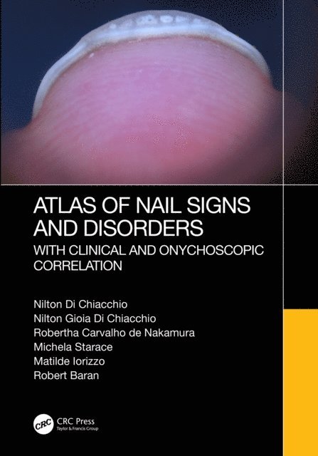 Robert Baran, Matilde Iorizzo, Michela Starace, Robertha Carvalho de Nakamura, Nilton Gioia Di Chiacchio, Nilton Di Chiacchio - Atlas of Nail Signs and Disorders with Clinical and Onychoscopic Correlation, E-bok