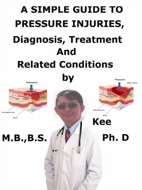 Kenneth Kee - Simple Guide To Pressure Injuries, Diagnosis, Treatment And Related Conditions, E-bok. Tillgänglighet: Lägg i varukorg