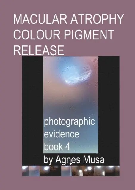 Agnes Musa - Macular Atrophy Colour Pigment Release, Photographic Evidence Book 4, E-bok. Tillgänglighet: Lägg i varukorg