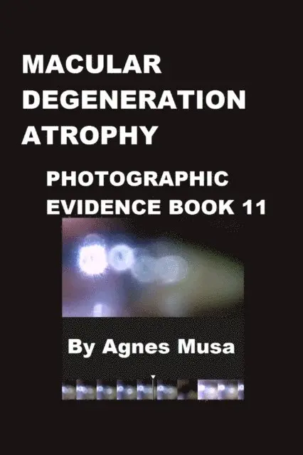 Agnes Musa - Macular Degeneration Atrophy, Photographic Evidence Book 11, E-bok. Tillgänglighet: Lägg i varukorg
