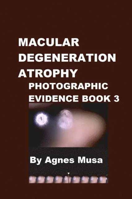 Agnes Musa - Macular Degeneration Atrophy, Photographic Evidence Book 3, E-bok. Tillgänglighet: Lägg i varukorg