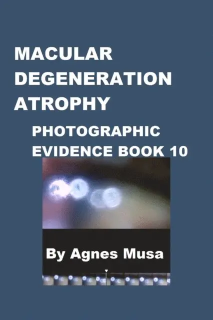 Agnes Musa - Macular Degeneration Atrophy, Photographic Evidence Book 10, E-bok. Tillgänglighet: Lägg i varukorg