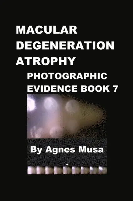 Agnes Musa - Macular Degeneration Atrophy, Photographic Evidence Book 7, E-bok. Tillgänglighet: Lägg i varukorg