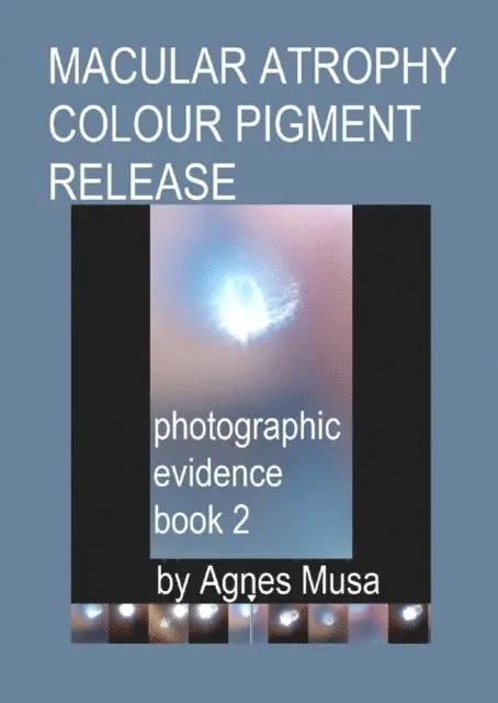Agnes Musa - Macular Atrophy Colour Pigment Release, Photographic Evidence Book 2, E-bok. Tillgänglighet: Lägg i varukorg