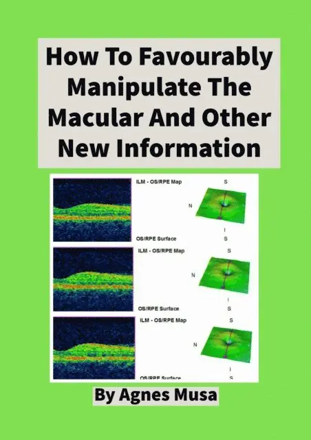 Agnes Musa - How To Favourably Manipulate The Macular  And Other New Information, E-bok. Tillgänglighet: Lägg i varukorg