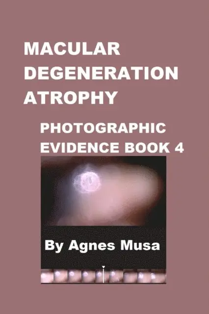 Agnes Musa - Macular Degeneration Atrophy, Photographic Evidence Book 4, E-bok. Tillgänglighet: Lägg i varukorg