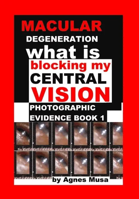 Agnes Musa - Macular Degeneration, What Is Blocking My Central Vision, Photographic Evidence Book 1, E-bok. Tillgänglighet: Lägg i varukorg
