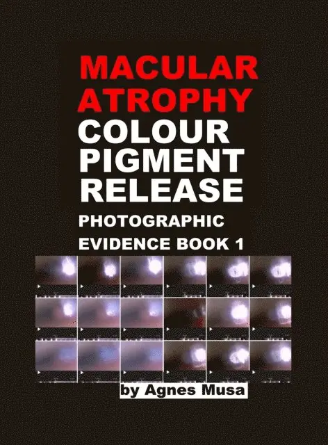 Agnes Musa - Macular Atrophy Colour Pigment Release, Photographic Evidence Book 1, E-bok. Tillgänglighet: Lägg i varukorg