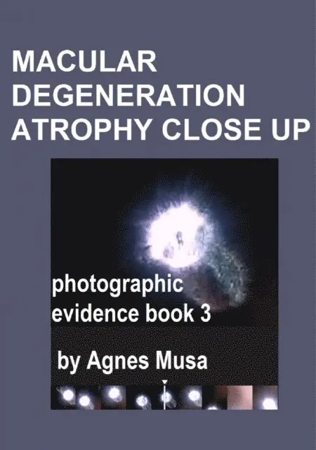 Agnes Musa - Macular Degeneration Atrophy Close Up, Photographic Evidence Book 3, E-bok. Tillgänglighet: Lägg i varukorg