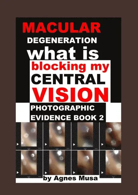 Agnes Musa - Macular Degeneration, What Is Blocking My Central Vision, Photographic Evidence Book 2, E-bok. Tillgänglighet: Lägg i varukorg