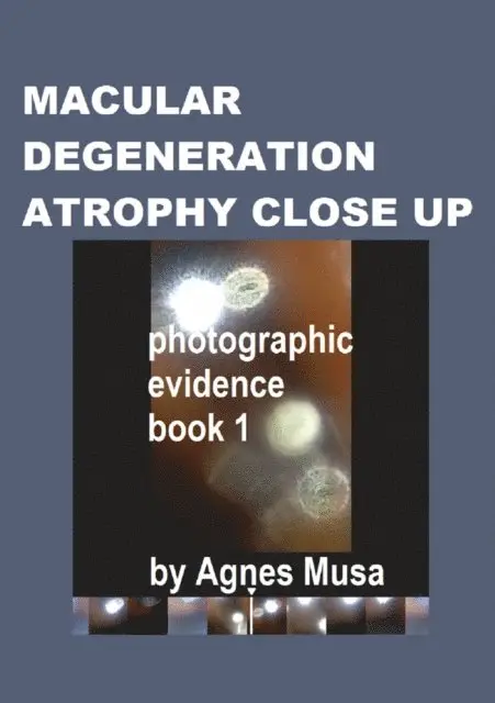 Agnes Musa - Macular Degeneration Atrophy Close Up, Photographic Evidence Book 1, E-bok. Tillgänglighet: Lägg i varukorg