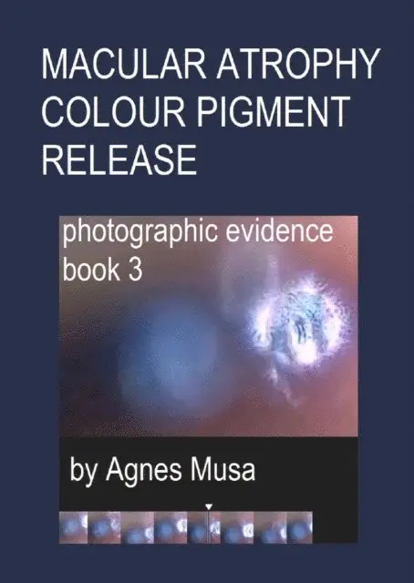 Agnes Musa - Macular Atrophy Colour Pigment Release, Photographic Evidence Book 3, E-bok. Tillgänglighet: Lägg i varukorg