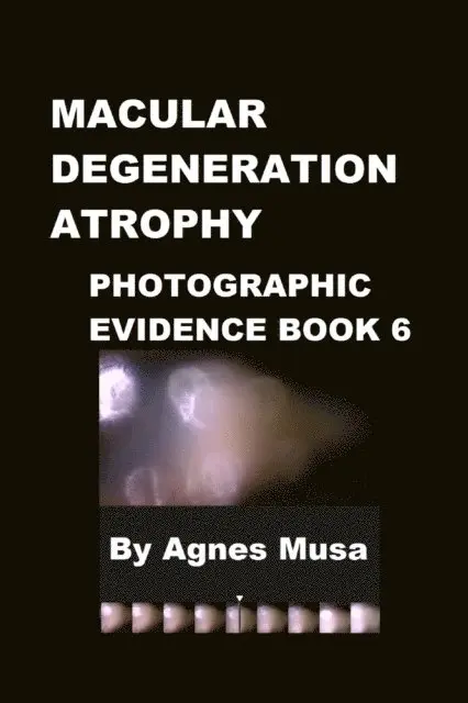 Agnes Musa - Macular Degeneration Atrophy, Photographic Evidence Book 6, E-bok. Tillgänglighet: Lägg i varukorg