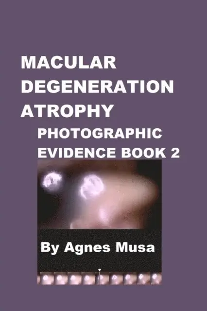 Agnes Musa - Macular Degeneration Atrophy, Photographic Evidence Book 2, E-bok. Tillgänglighet: Lägg i varukorg