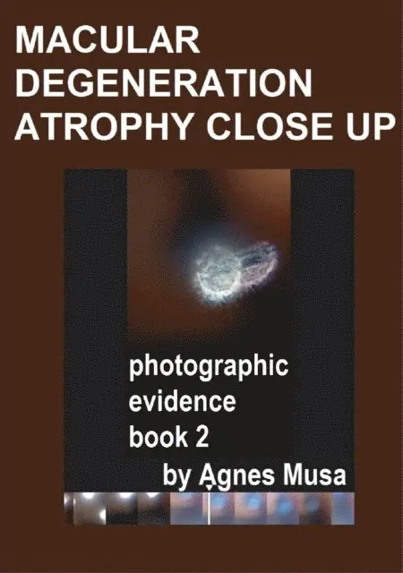 Agnes Musa - Macular Degeneration Atrophy Close Up, Photographic Evidence Book 2, E-bok. Tillgänglighet: Lägg i varukorg
