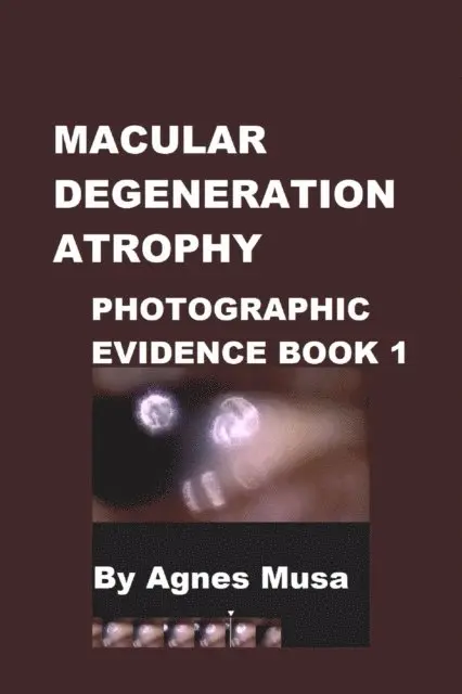 Agnes Musa - Macular Degeneration Atrophy, Photographic Evidence Book 1, E-bok. Tillgänglighet: Lägg i varukorg