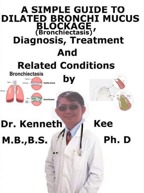 Simple Guide to Dilated Bronchi, Mucus Blockage (Bronchiectasis), Diagnosis, Treatment and Related Conditions