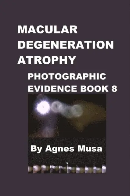Macular Degeneration, Photographic Evidence Book 8