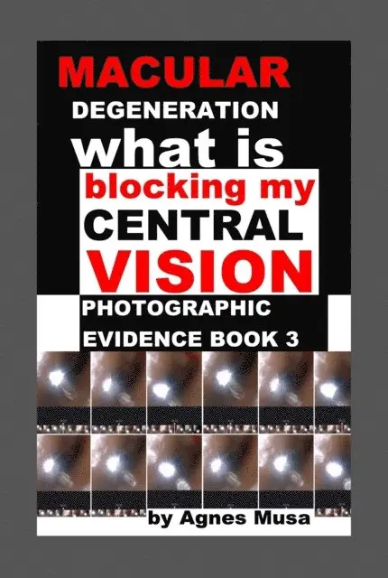 Agnes Musa - Macular Degeneration, What Is Blocking My Central Vision, Photographic Evidence Book 3, E-bok. Tillgänglighet: Lägg i varukorg