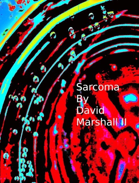 David Marshall - Sarcoma, E-bok