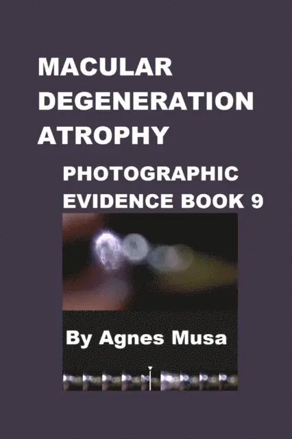 Agnes Musa - Macular Degeneration Atrophy, Photographic Evidence Book 9, E-bok. Tillgänglighet: Lägg i varukorg